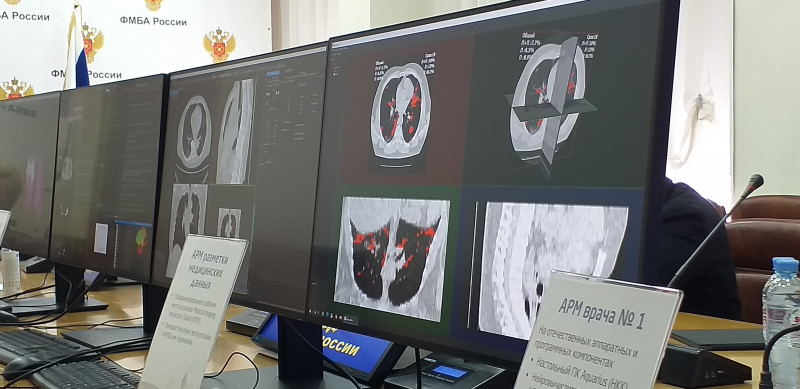 АРМ для работы с медицинским искусственным интеллектом представили в ФМБА